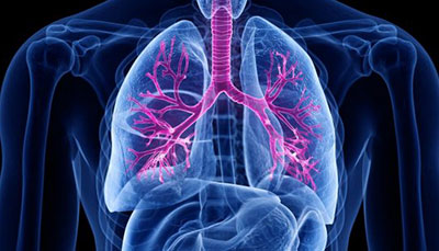 什么是慢性阻塞性肺病 (Chronic Obstructive Pulmonary Disease)，為何與新冠疫情有關(guān)？